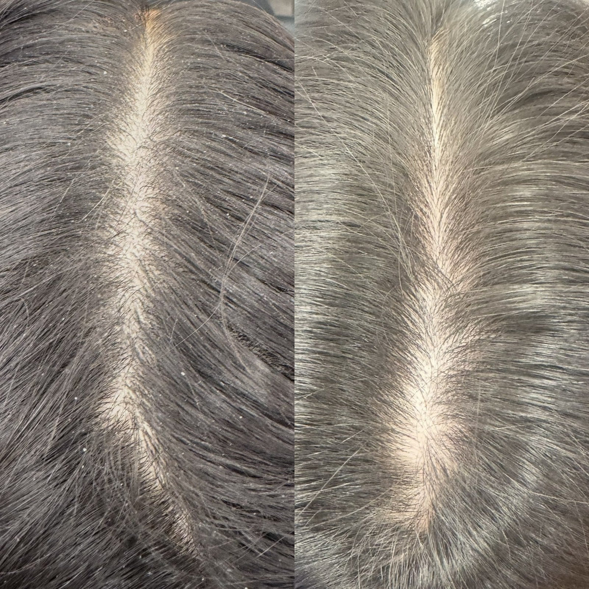 Voor en na: minder schilfers met de Purifying Scalp Scrub
